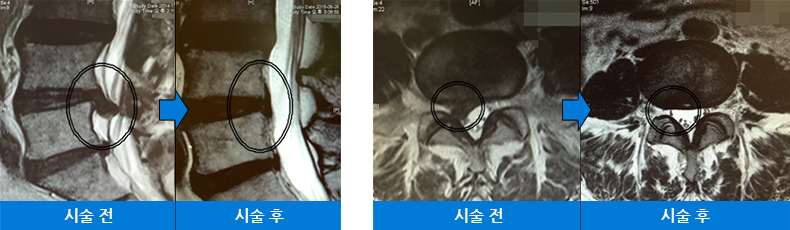 시술 전 후