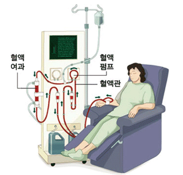 혈액투석